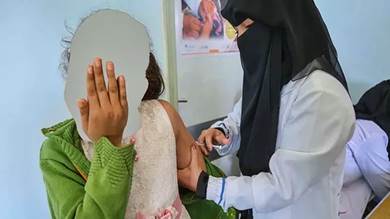 5 ألاف إصابة و53 حالة وفاة.. الحصبة تخطف أرواح الأطفال في اليمن
